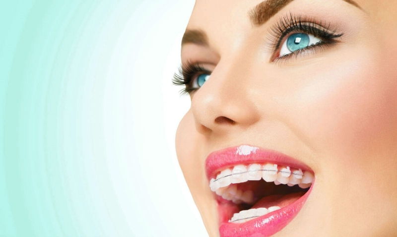 Odontología estética en Margarita - KOi Dental - Cosmética dental Odontología estética en Margarita - KOi Dental - Cosmética dental